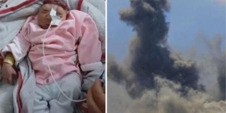 ولادة طفلة بلا دماغ مع تزايد ظاهرة "تشوه الأجنة" في قطاع غزة