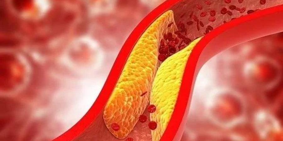 مشروبات تسهم في خفض الكوليسترول بشكل طبيعي