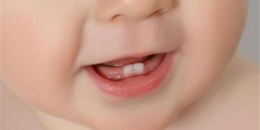 3 علامات مهمة تشير لتسنين الأطفال