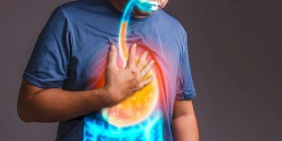 دكتور جهاز هضمي: علاج ارتجاع المريء في نظام الحياة