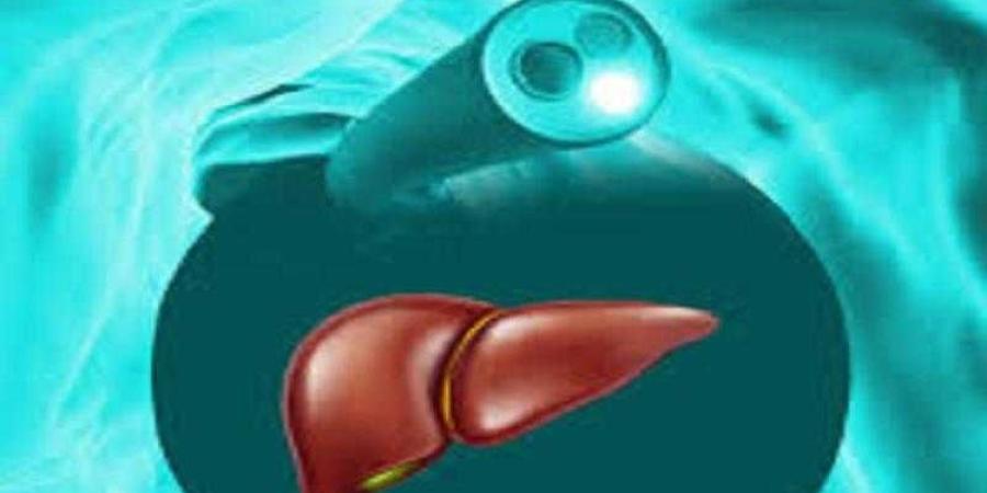 مضاعفات تصل لـ”السرطان”.. تعرف علي أسباب وأعراض وطرق الوقاية من ”الكبد الدهني”